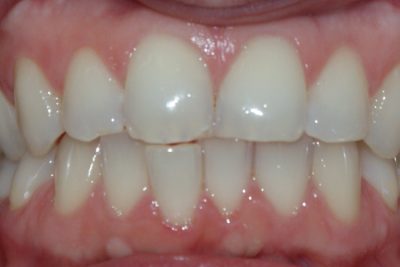 Ortodonta poznań 42