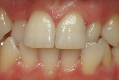 Ortodoncja poznań 3